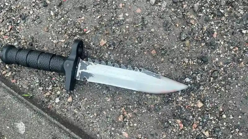 Замах на вбивство у Вінниці: чоловік штрикнув ножем нового знайомого після розпивання алкоголю Замах на вбивство у Вінниці: чоловік штрикнув ножем нового знайомого після розпивання алкоголю